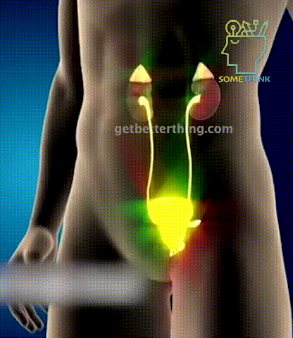 4.gif